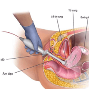 Profile photo of sieuamsan