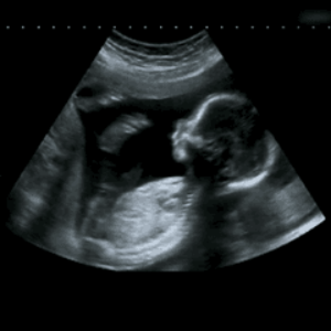 Profile photo of sieuam